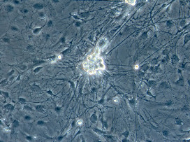 Клетки кожи напрямую превратили в нейроны