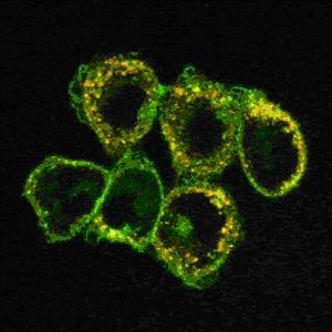 Могут ли наночастицы вызывать гибель клеток?