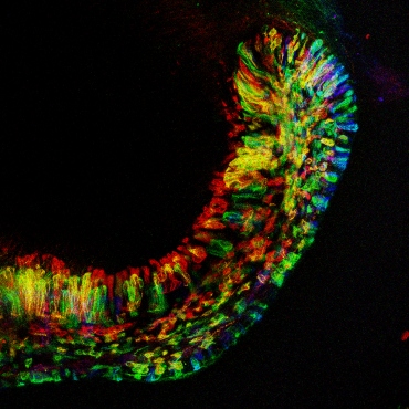 Зуб лабораторной мыши позволит по-новому взглянуть на процесс регенерации тканей